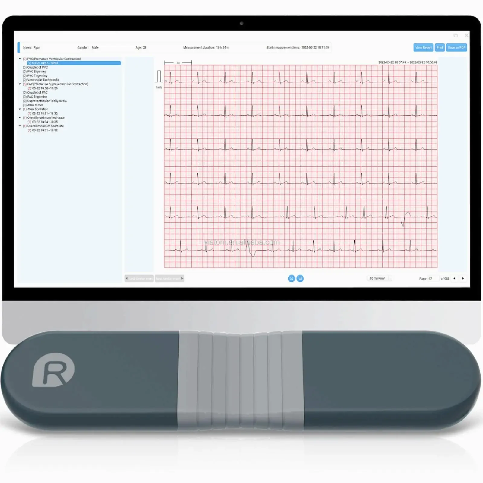 Bezprzewodowy rejestrator Blue – Ecg Patch Monitor recenzja i cena